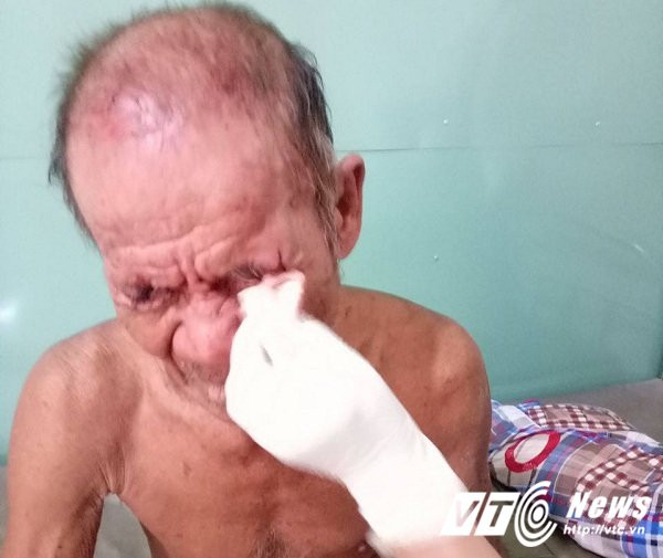 Hinh anh Nghich tu danh cha nhap vien nhap vien o Binh Duong: Chau gai quay clip tiet lo thong tin bat ngo 3