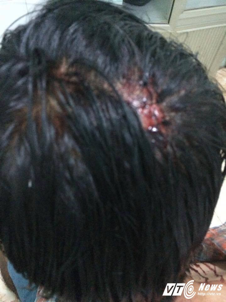 Hinh anh Gan 30 thanh nien xam tro danh tua mau dau nguoi dan ong tat nguyen 