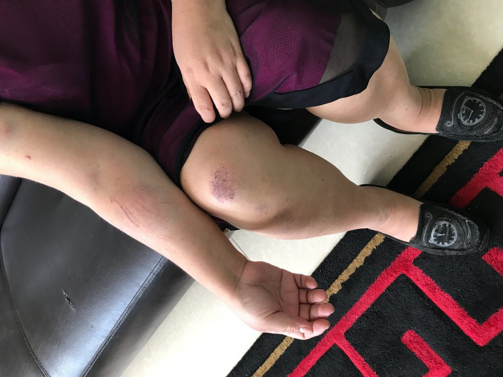 Hinh anh Nhom thanh nien danh nguoi,“cuop nha” roi keo le 2 nguoi phu nu ra duong