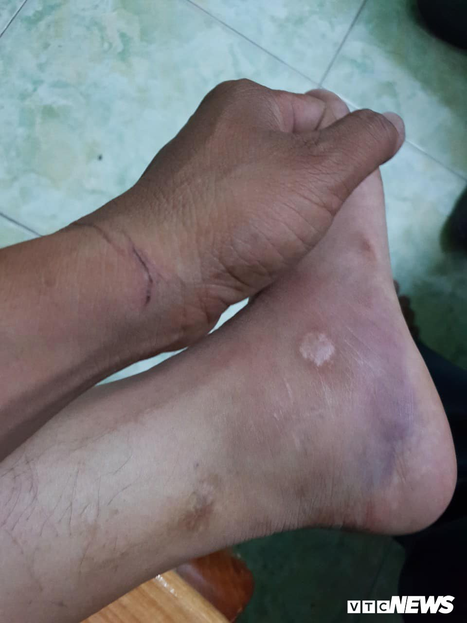 35756899_1703720216415844_3607374037279309824_n 3