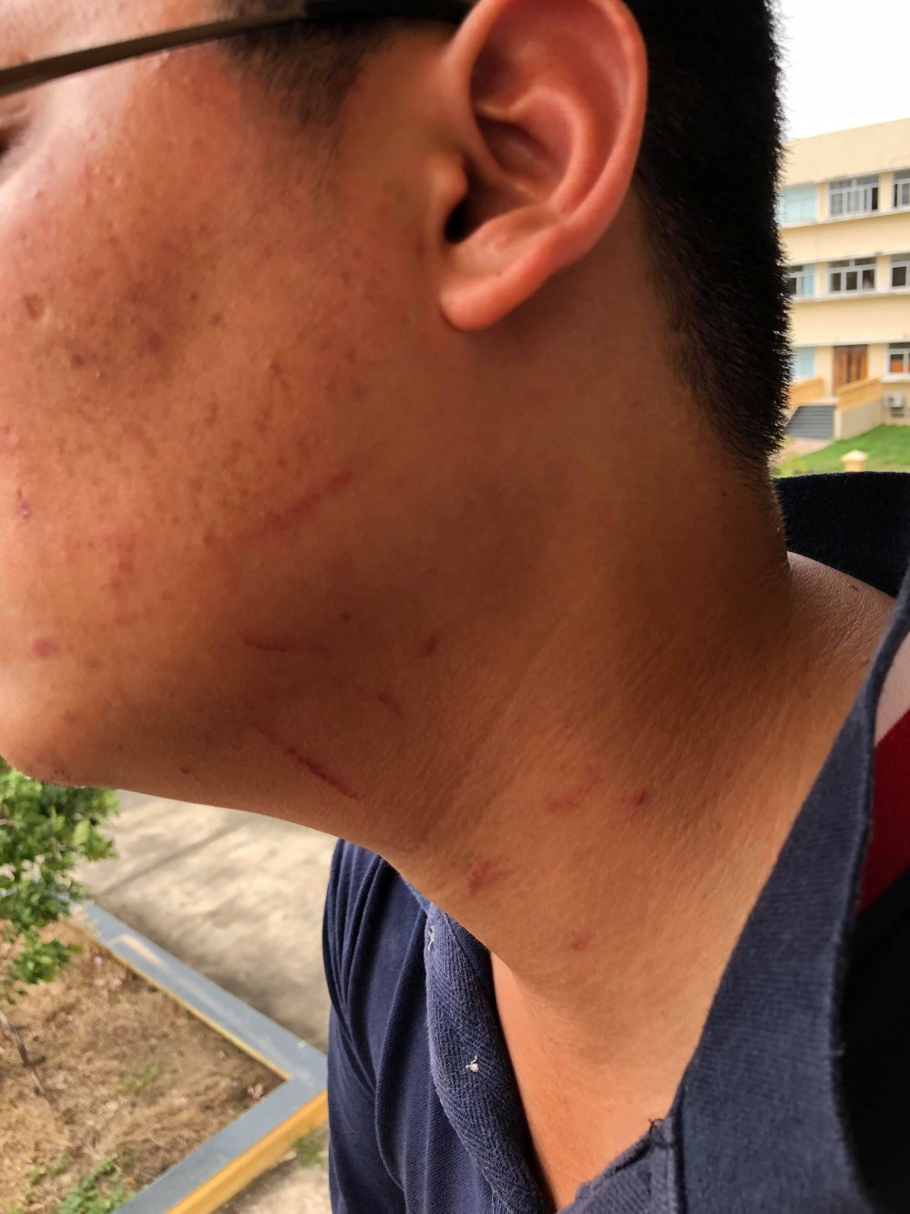 37648684_1790263197759114_25632626815533056_n