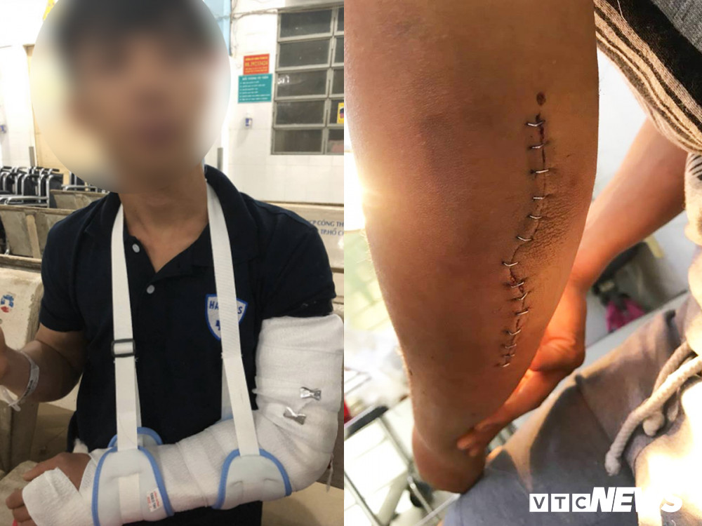 49140185_1080987902109252_468370860848185344_n 5