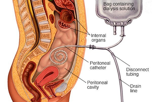 20170601091809-chay-than2