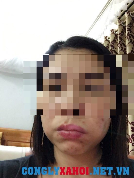 meo mom vi lam ma lum