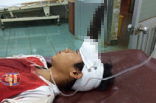 be trai 12 tuoi bi dao gam vao tran 3