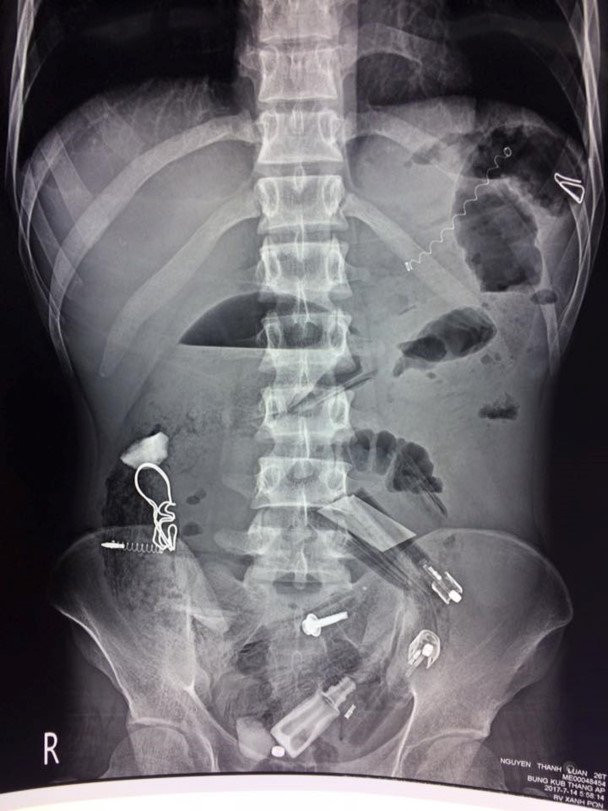 19961339_2014577208584373_3052001510671699160_n_fzet