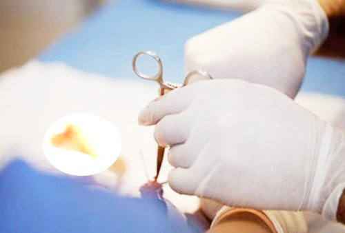 bao-quy-dau-8299-1502442371