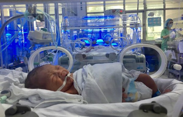 be-sinh-non-1-1-8382-1511506510