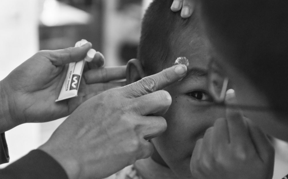 TRE_EM_NHIEM_HIV_29 20