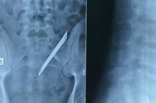 lu-o-i-dao-9165-1513389494