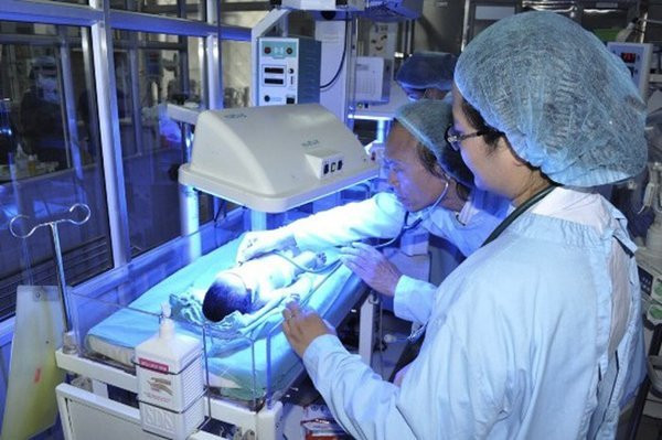 74-ngay-hoi-sinh-cua-cap-song-sinh-1kg-khong-khoc-khong-tho