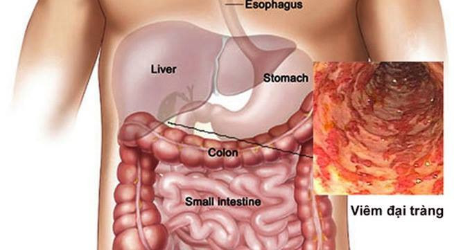 45320859_253564898674955_7010613205307228160_n