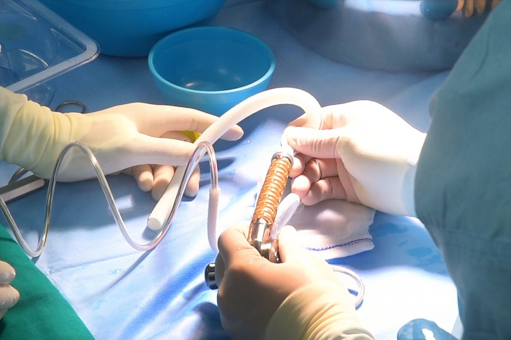 A5_Ky thuat ghep tim 5