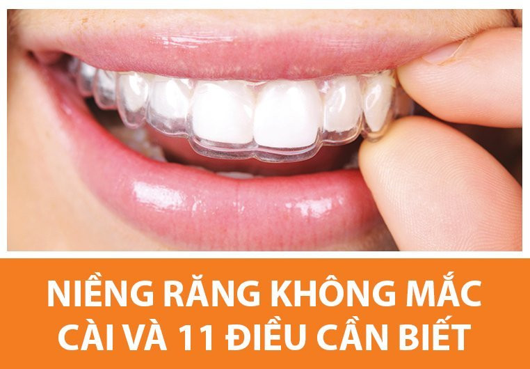 Nieng rang khong mac cai va 11 dieu can biet neu khong muon 'mang tien bo bien' hinh anh 1