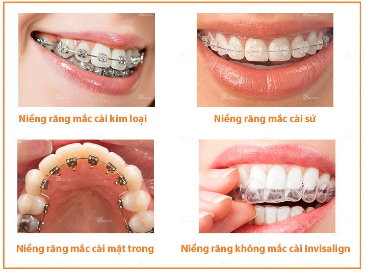 2-nieng-rang-gia-bao-nhieu-tien
