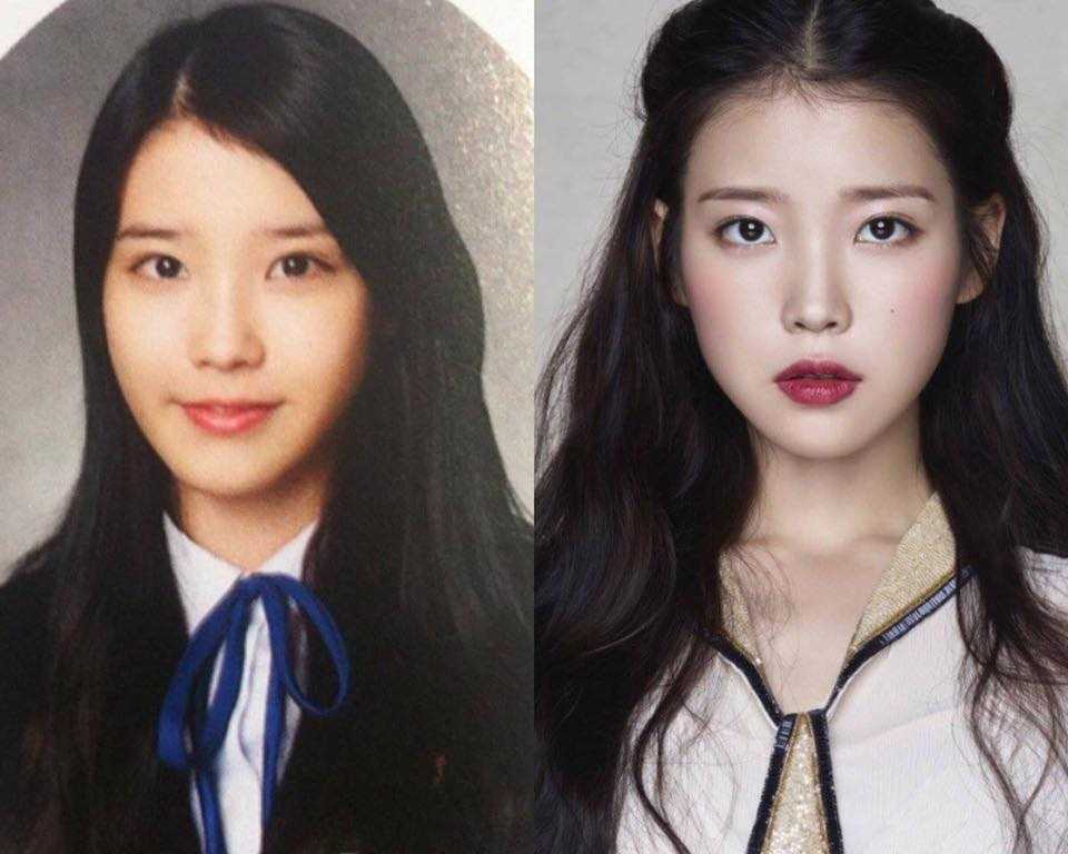 iu 2