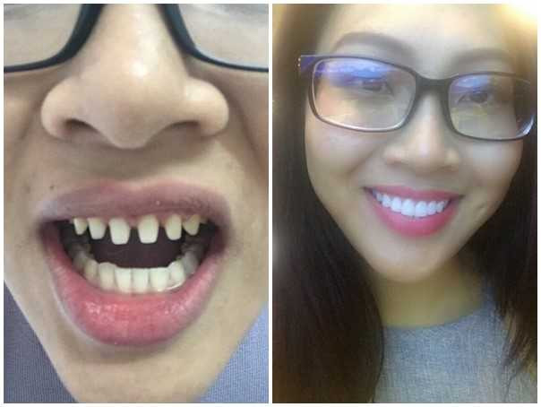 Dai dien Viet o Hoa hau The gioi bi to phau thuat tham my hinh anh 3