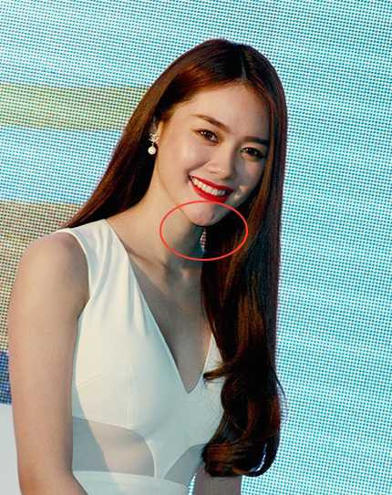 22linh-chi-phau-thuat-tha