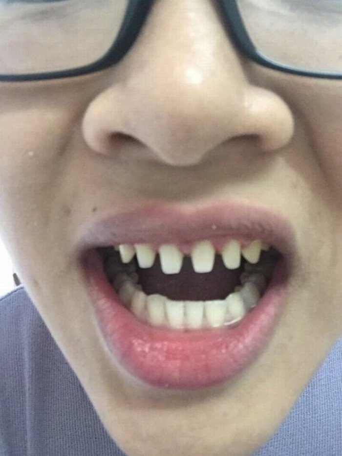 batch_5-1508058262111 3