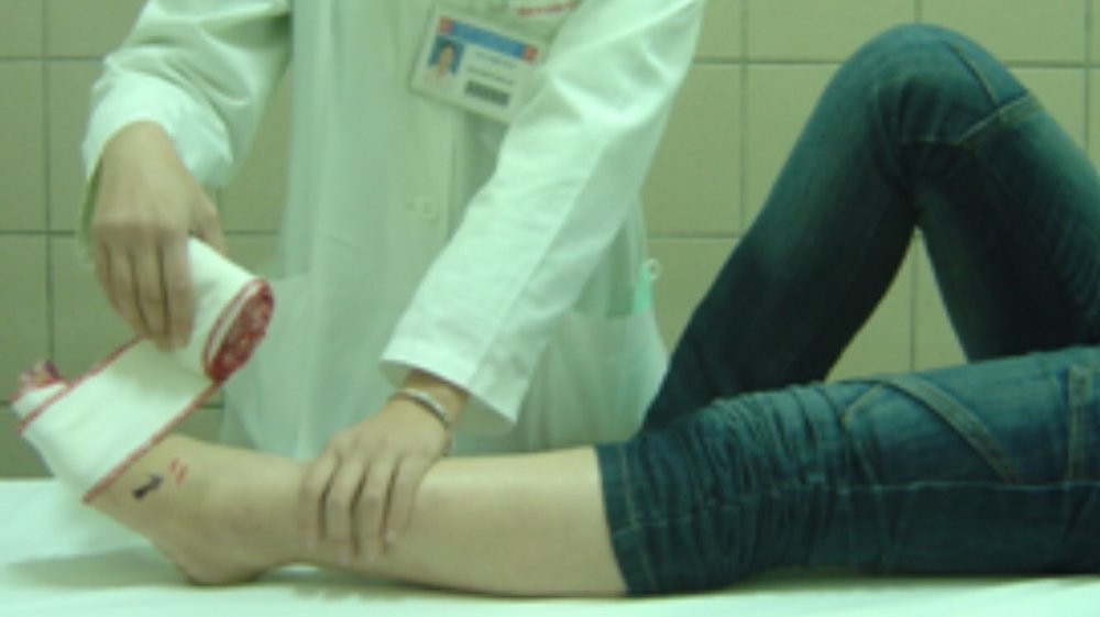 nep-vet-thuong-ran-can