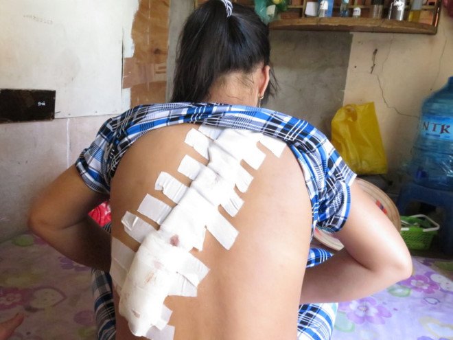 Mat nha, bi chem vi di vay 'nong' hinh anh 2