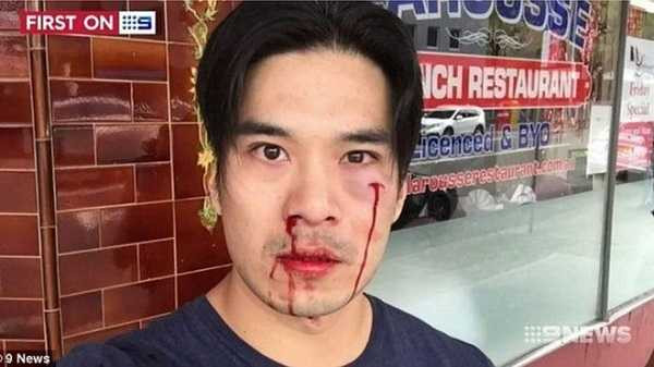 dien-vien-truy-sat-bi-danh-chay-mau-mui-me-rang-o-sydney