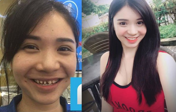 37-1-1501165646164-1501166047444