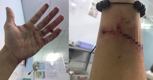 Dong Hung: '4 nam lam viec kiet suc de tra khoan no 16 ty dong cho me' hinh anh 1