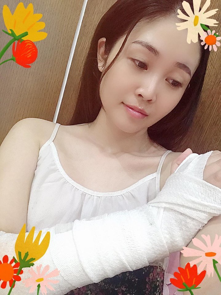 Hai MC VTV ngã gãy tay, mổ dây chằng phải nhập viện