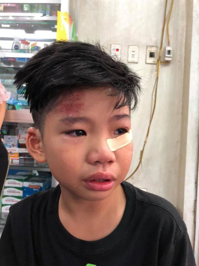 Con trai siêu mẫu Hạ Vy bị ô tô tông chấn động não rồi bỏ đi