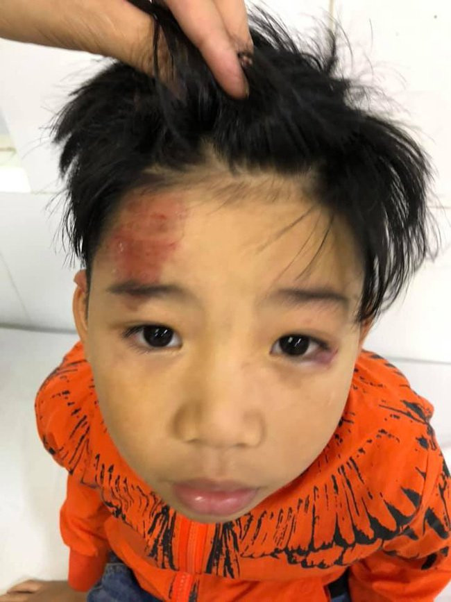 Con trai siêu mẫu Hạ Vy bị ô tô tông chấn động não rồi bỏ đi