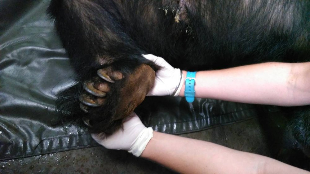 móng quáp vào bàn chân 11