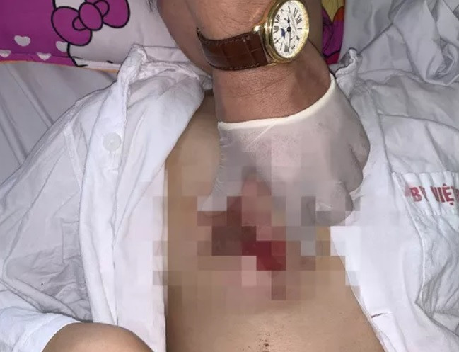 phau-thuat-tham-my-nguc