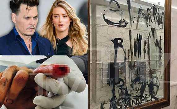 Johnny bị mất đầu ngón tay sau vụ xô xát ở Australia.