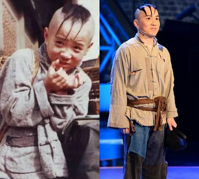 Tai tu 'Tam Mao' phai dong kich muu sinh vi benh la hinh anh 2