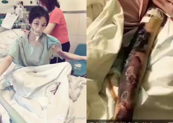 Giai nhan 'Tay Thi' qua doi sau 2 thang ung thu vi giac hoi hinh anh 3