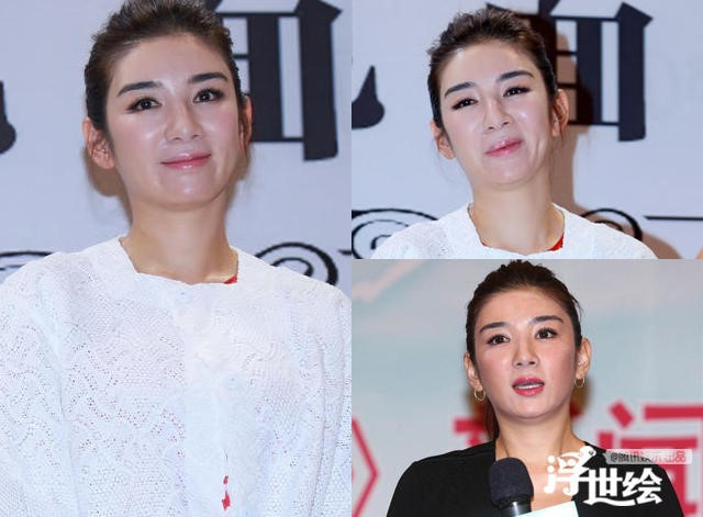 Giai nhan Trung Quoc mat bien dang khi tiem botox qua da hinh anh 3