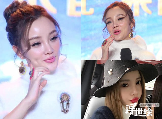 Giai nhan Trung Quoc mat bien dang khi tiem botox qua da hinh anh 2