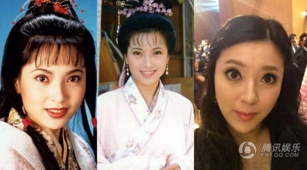 Giai nhan Trung Quoc mat bien dang khi tiem botox qua da hinh anh 5