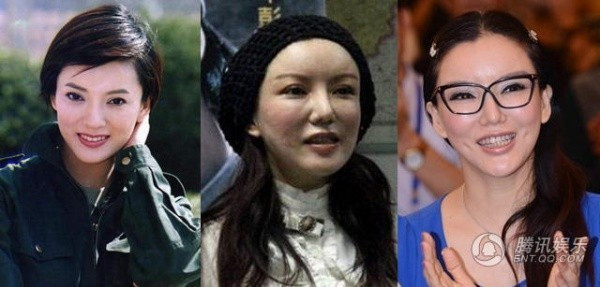 Giai nhan Trung Quoc mat bien dang khi tiem botox qua da hinh anh 6