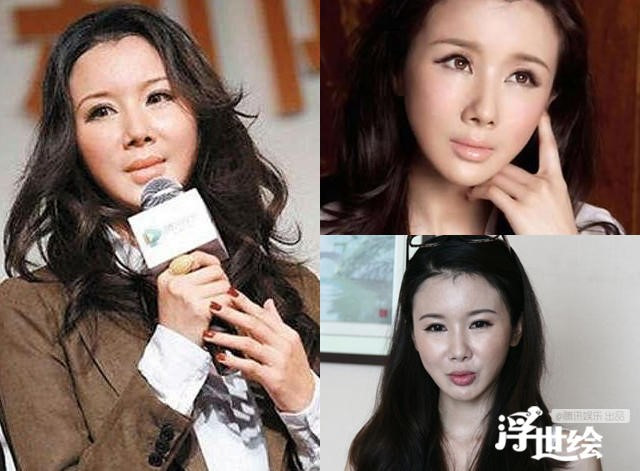 Giai nhan Trung Quoc mat bien dang khi tiem botox qua da hinh anh 4