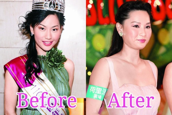 Giai nhan Trung Quoc mat bien dang khi tiem botox qua da hinh anh 7