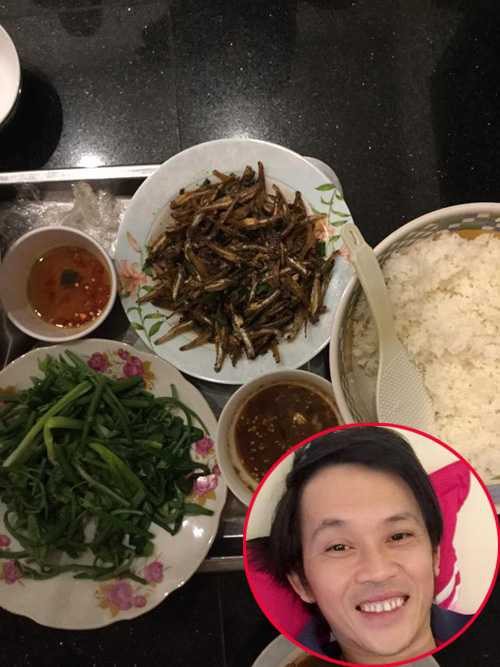 Lý do khiến Hoài Linh phải nhập viện cấp cứu - 3