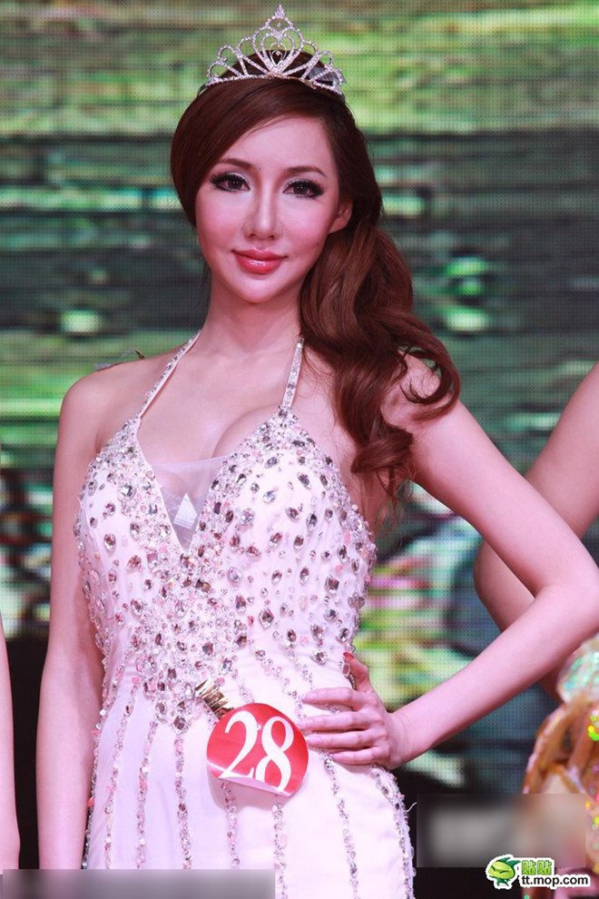 Sieu mau Trung Quoc tung anh bi ban trai danh dap suot 3 nam hinh anh 2