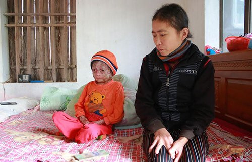 thieu-nien-17-nam-chong-choi-voi-can-benh-y-hoc-khong-the-chua-khoi