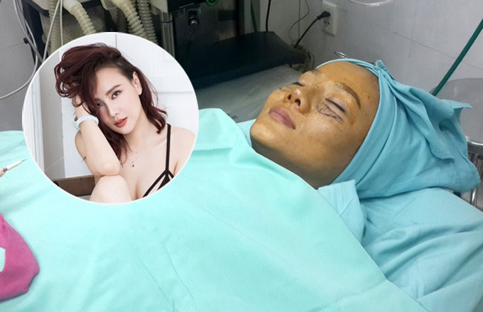 nhung-sao-viet-tung-cong-khai-qua-trinh-phau-thuat-thm-my-2