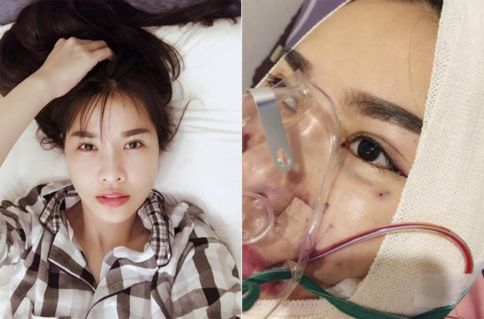 nhung-sao-viet-tung-cong-khai-qua-trinh-phau-thuat-thm-my