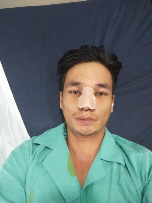 le-roi-sau-phau-thuat-tham-my-7-ngoisao.vn-w720-h960