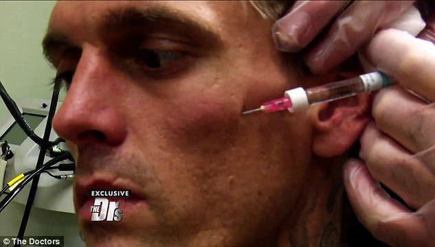 aaron-carter-lo-so-bi-nhiem-hiv-2