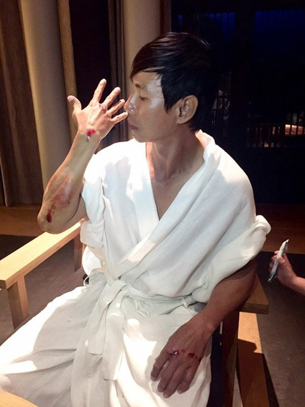 nhung-chan-thuong-cua-sao-viet-tren-phim-truong-1